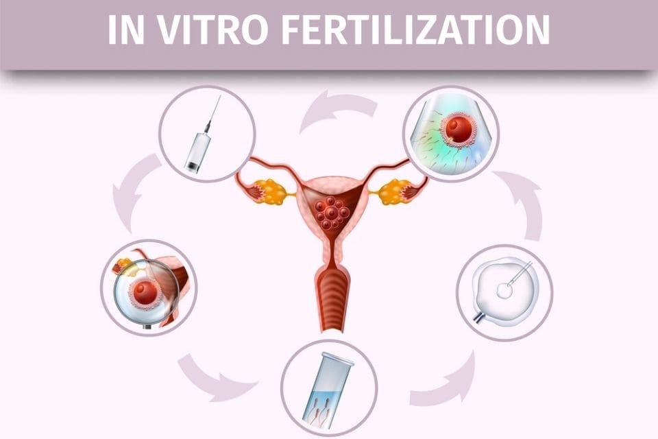 vruchtbaarheid ivf icsi iui